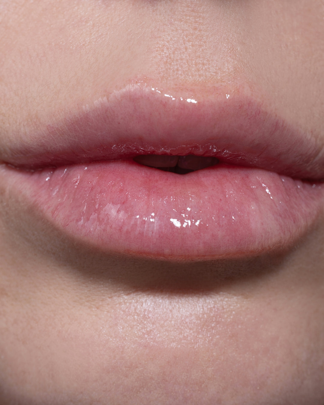Lip Serums F376 Set